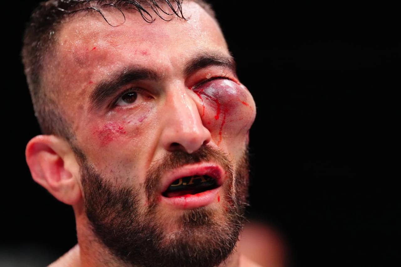 Местного бойца "разукрасили" на турнире UFC в ОАЭ