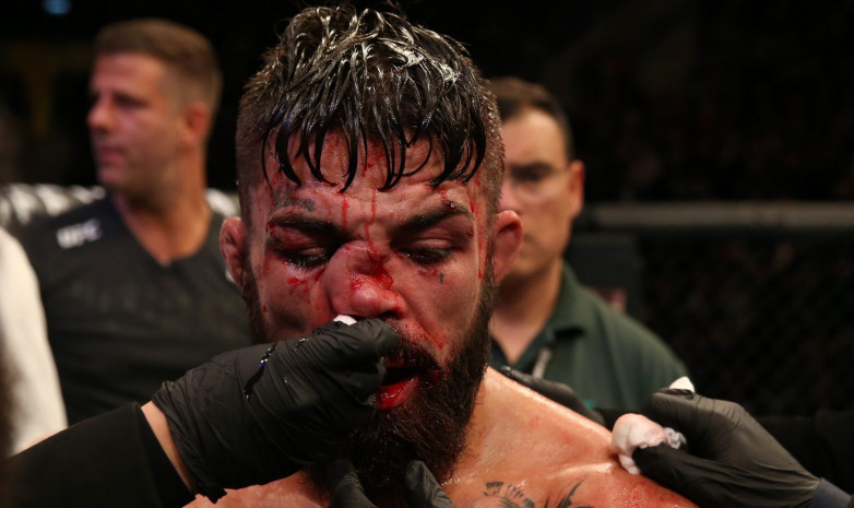 UFC жауынгері аса ауыр жарақат алды. Видео