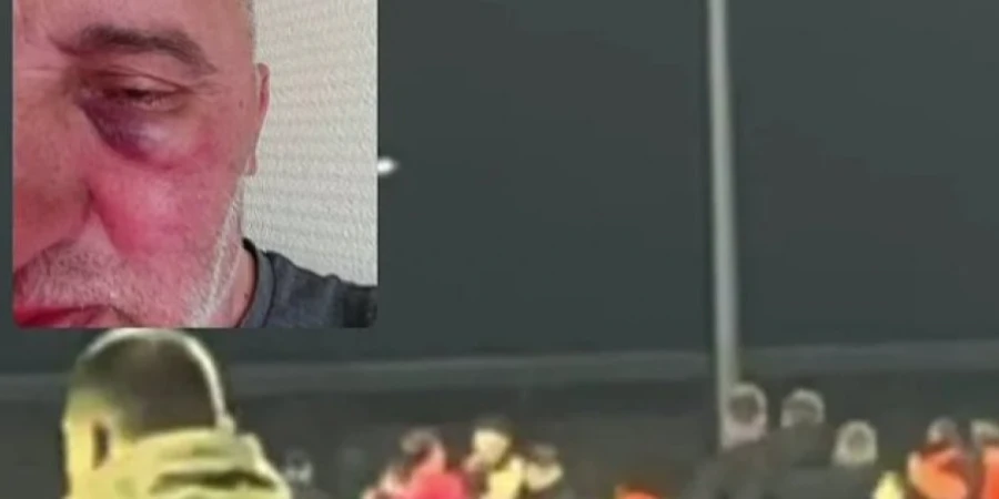 В массовой драке на поле участвовали футболисты и руководители клубов