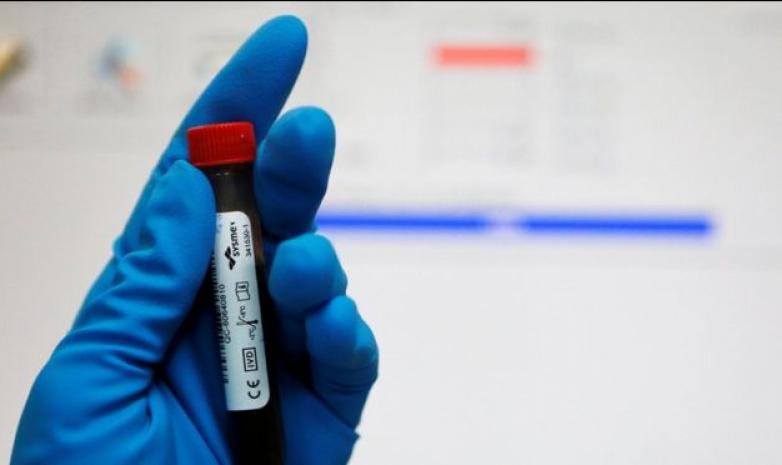 WADA: Допинг қолдануға үгіттеген тұлғаларды қылмыстық жауапкершілікке тарту қажет