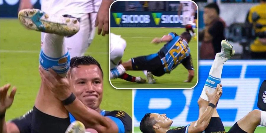 Бразильский защитник получил жуткую травму