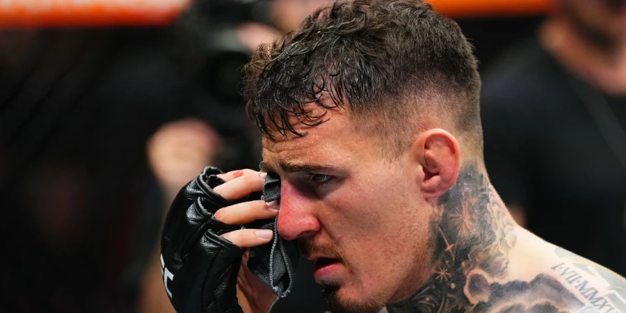 Чемпион UFC перенес операцию на обоих глазах после жуткой травмы