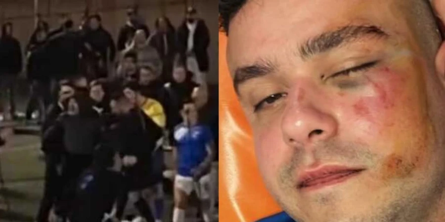 Матч в итальянском Неаполе завершился ранением футболиста