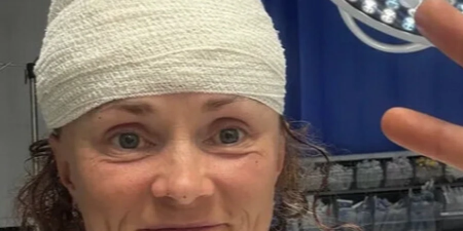 Российская легкоатлетка подверглась нападению собак во время пробежки на Кипре