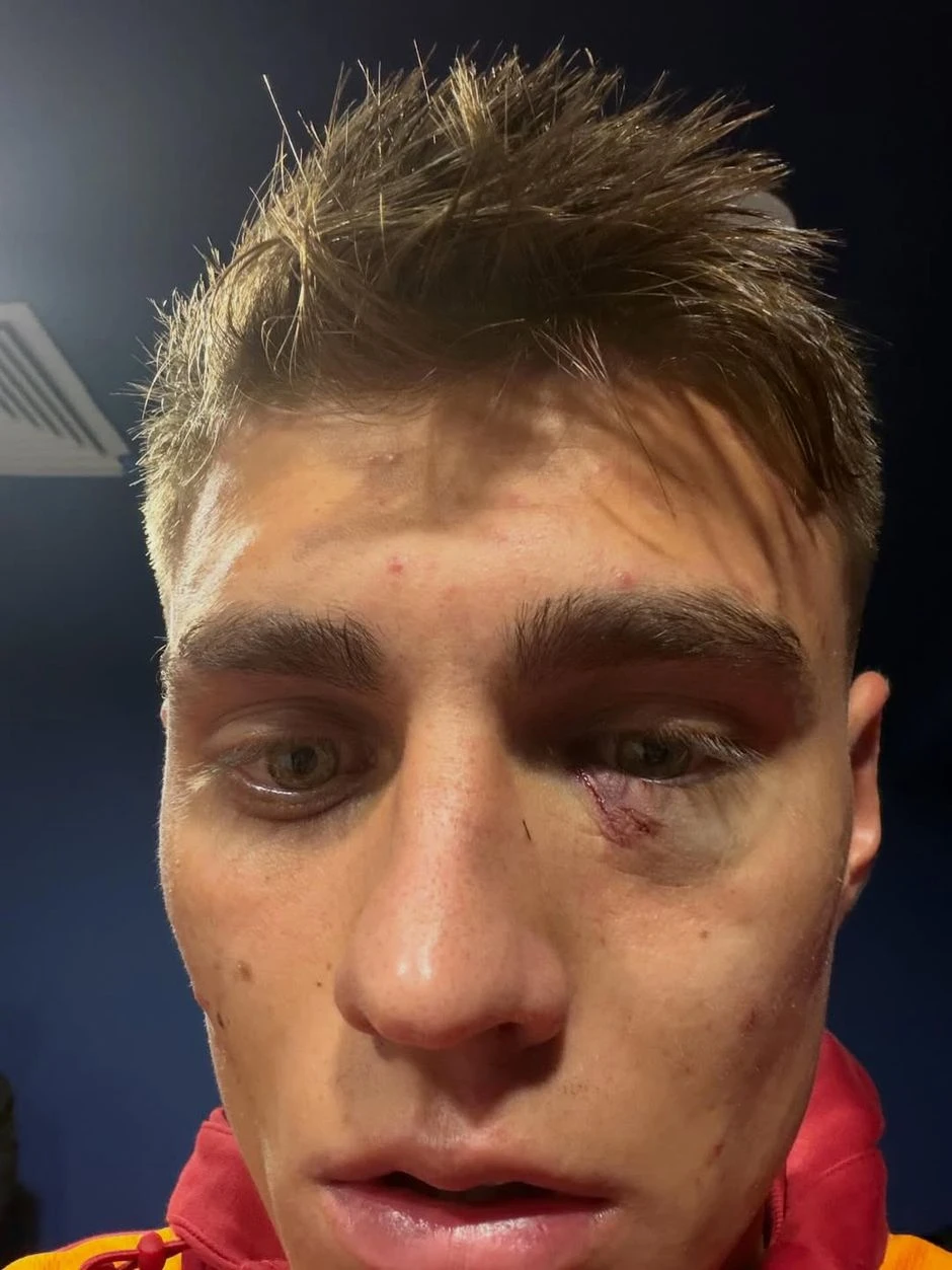 В матчах Фенербахче с Галатасараем гремит гром и сверкают молнии