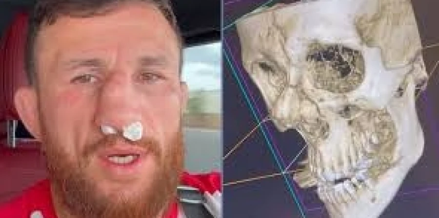 Бой Ян – Двалишвили 3 под вопросом после травмы грузинского бойца