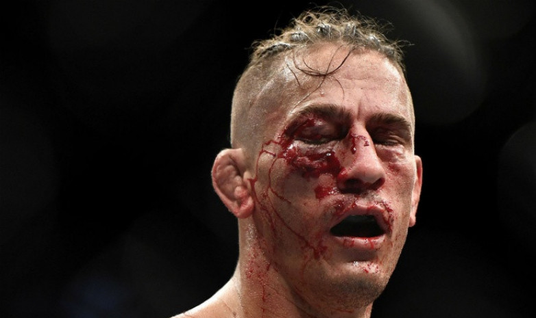 ФОТО. Боец получил жуткую гематому на турнире UFC 249. Ему присудили техническое поражение