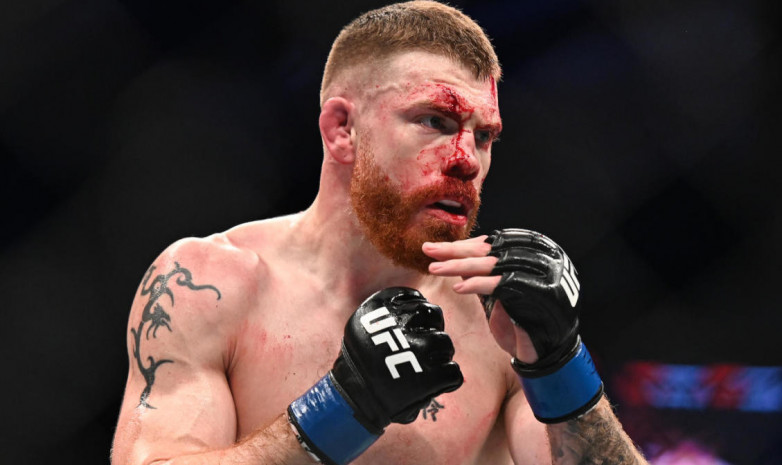 Боец UFC показал фотографии своих самых жутких травм. В том числе удаленный кусок легкого