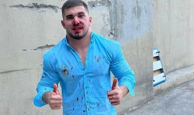 В Махачкале избили чеченского ММА-блогера Асхаба Тамаева