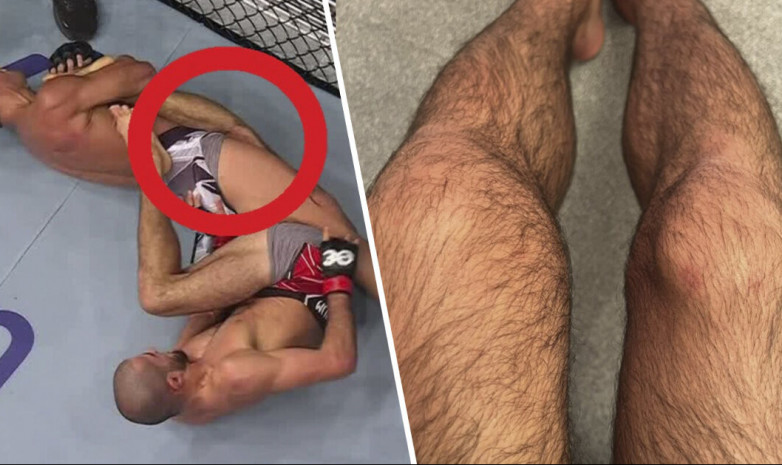Топовый суперлегковес UFC из России рассказал о травме во время боя