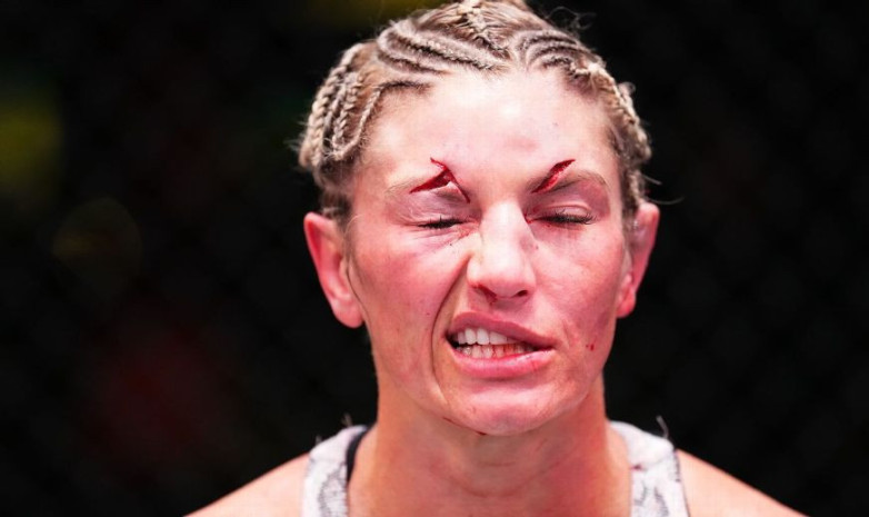 Девушка-боец UFC показала изуродованное лицо после боя. ФОТО
