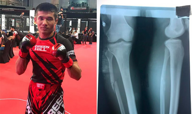 Казахстанец со сломанной ногой завоевал медаль на ЧМ по ММА  